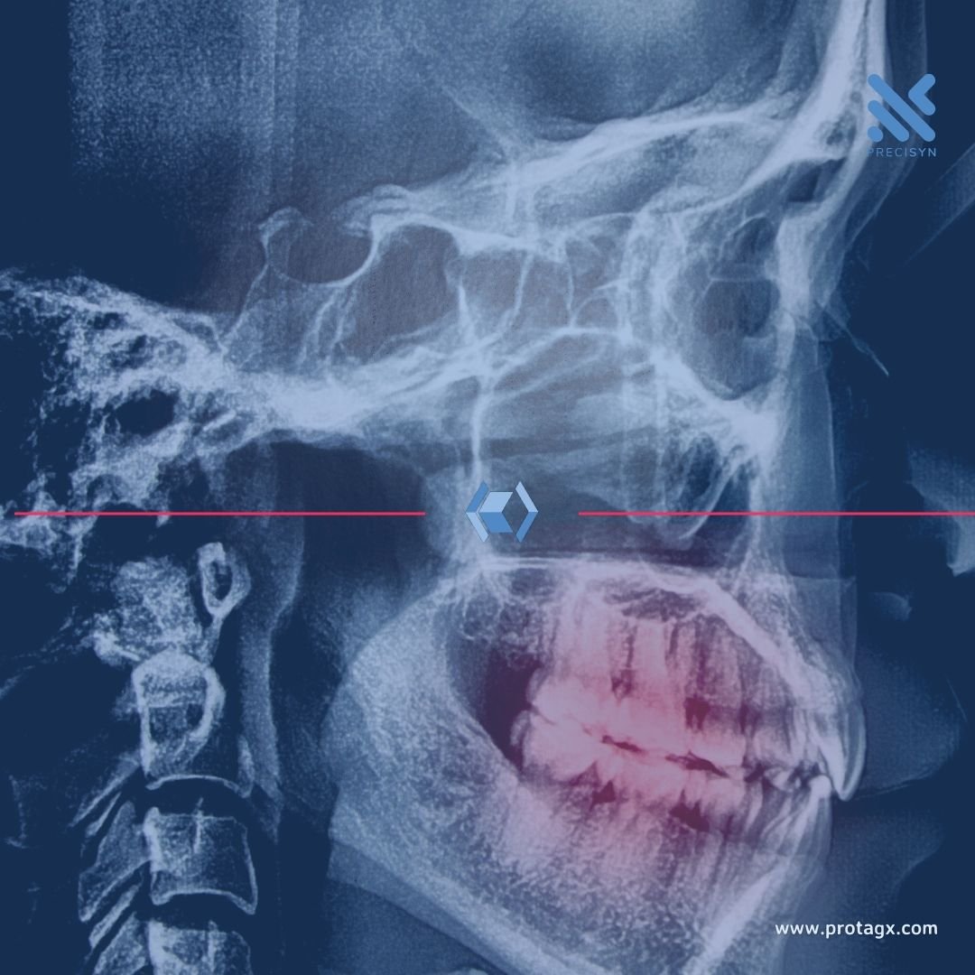 square - protagx - precision medicine (Instagram Post)_5